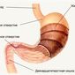 Названы самые популярные в России препараты для лечения желудка
