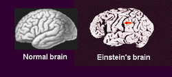 Медики раскрыли тайну мозга Эйнштейна