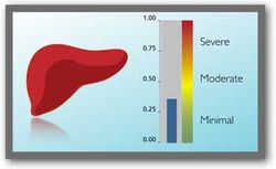 Fibrotest: инновационные диагностирования заболеваний печени - медики Израиля