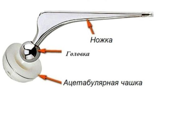 protez-sustava.jpg